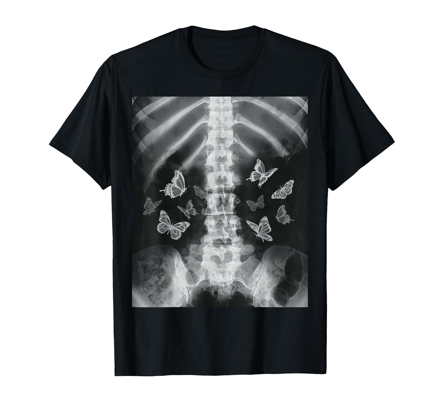 Skeleton Xray Butterfly Egirl Y2K T-Shirt - Unique Graphic Men Women - T-Shirt, Sweatshirt, Hoodie